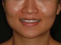 Konig Center for Cosmetic & Comprehensive Dentistry smile photos